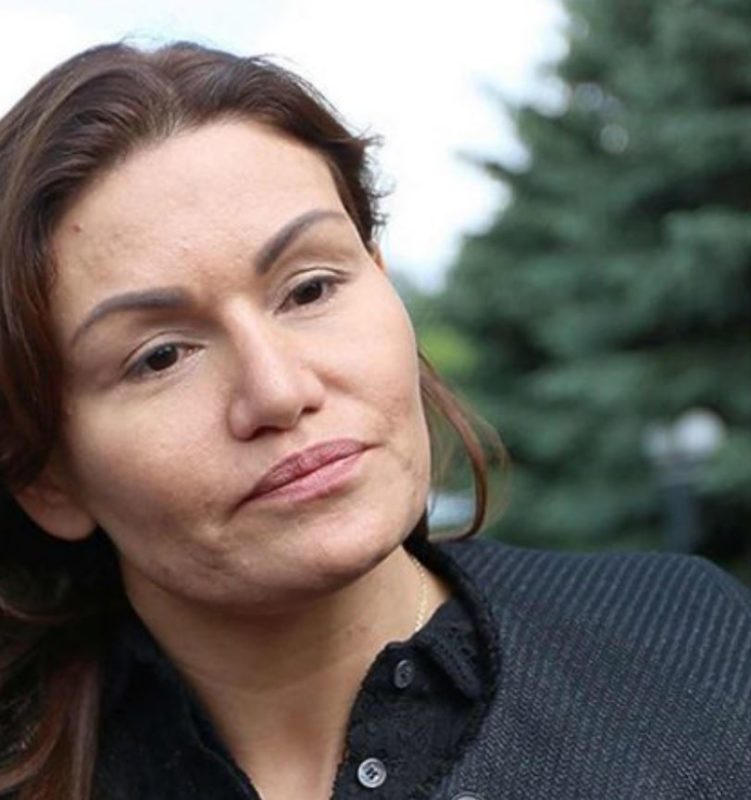 Пластика её кардинально изменила: как выглядит сейчас жена Андреева из «Иванушек»