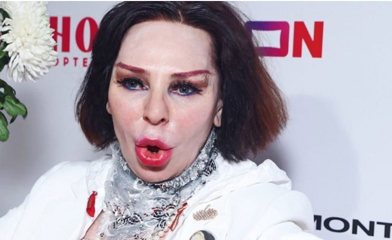 Неудачная пластика в прошлом, исправила последствия: Агузарова похорошела и помолодела